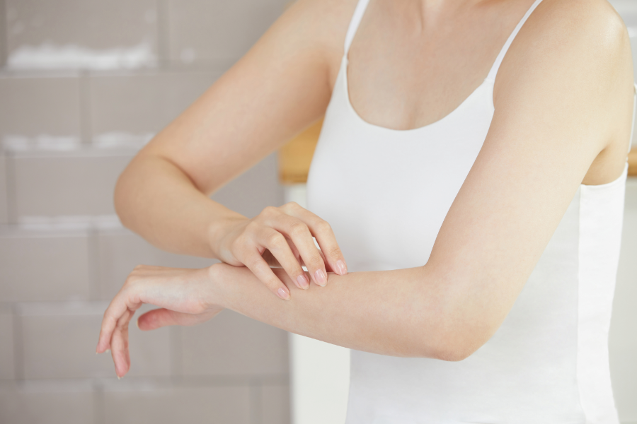 肌のかゆみの原因は？乾燥や虫刺され、汗や皮膚刺激によるトラブルを理解し、適切に対処しよう