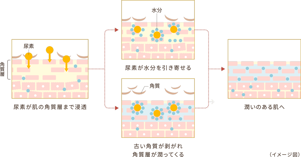 尿素20%が頑固なガサガサ・ゴチゴチに届く