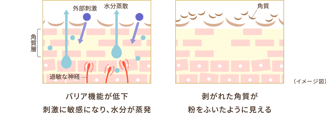 黒ずみ・さめ肌を治す