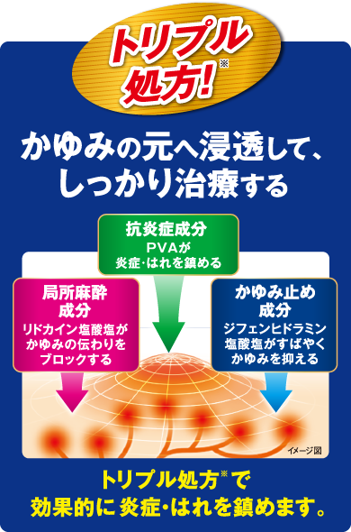 かゆみの元へ浸透して、しっかり治療する 局所麻酔成分リドカイン(塩酸塩)がかゆみの伝わり方をブロックする　抗炎症成分PVAが炎症・はれを鎮める　かゆみ止め成分ジフェンヒドラミン塩酸塩がすばやくかゆみを抑える　トリプル処方ですばやくかゆみを抑え、効果的に炎症・はれを鎮めます。イメージ図