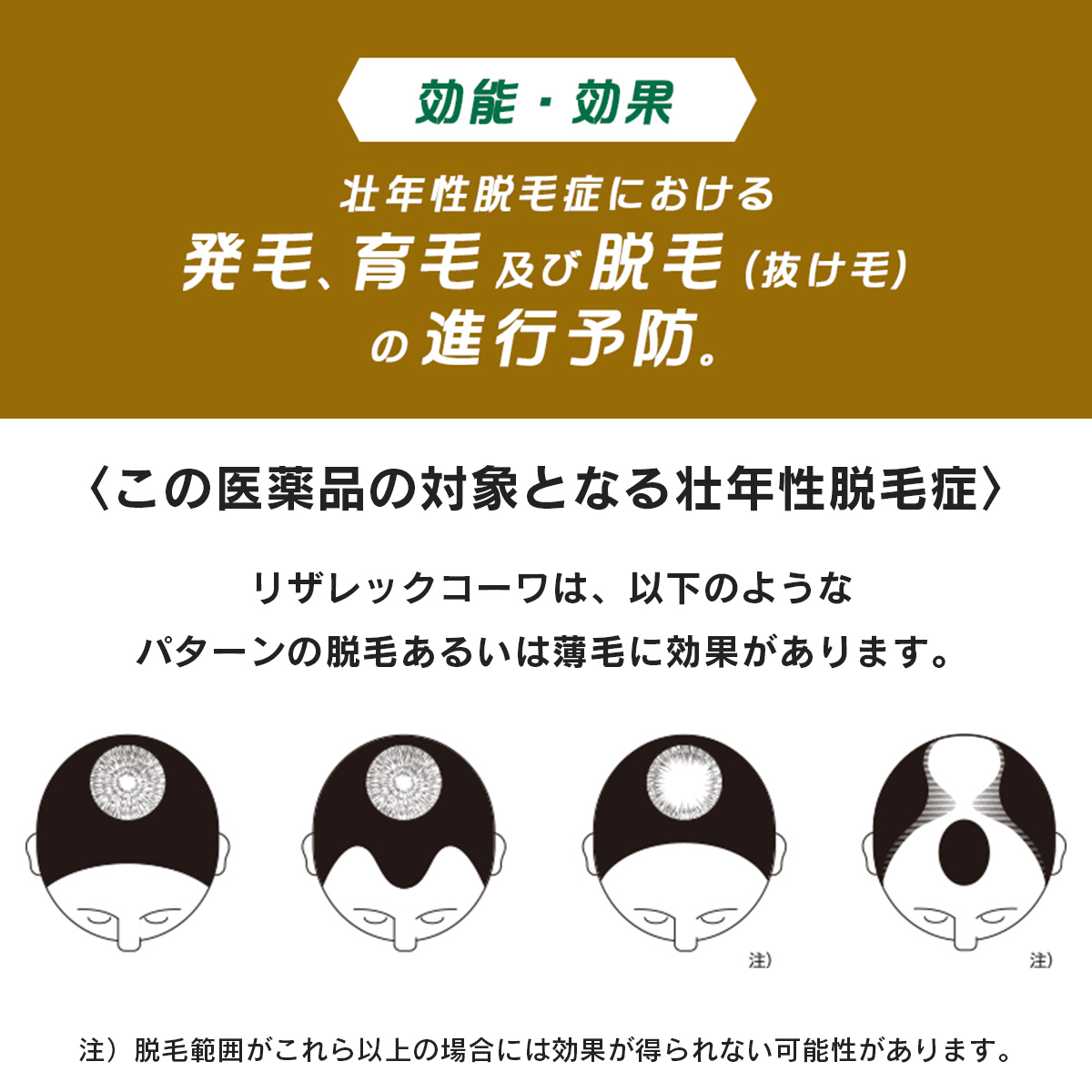 リザレックコーワ 72mL 【第1類医薬品】 72mL