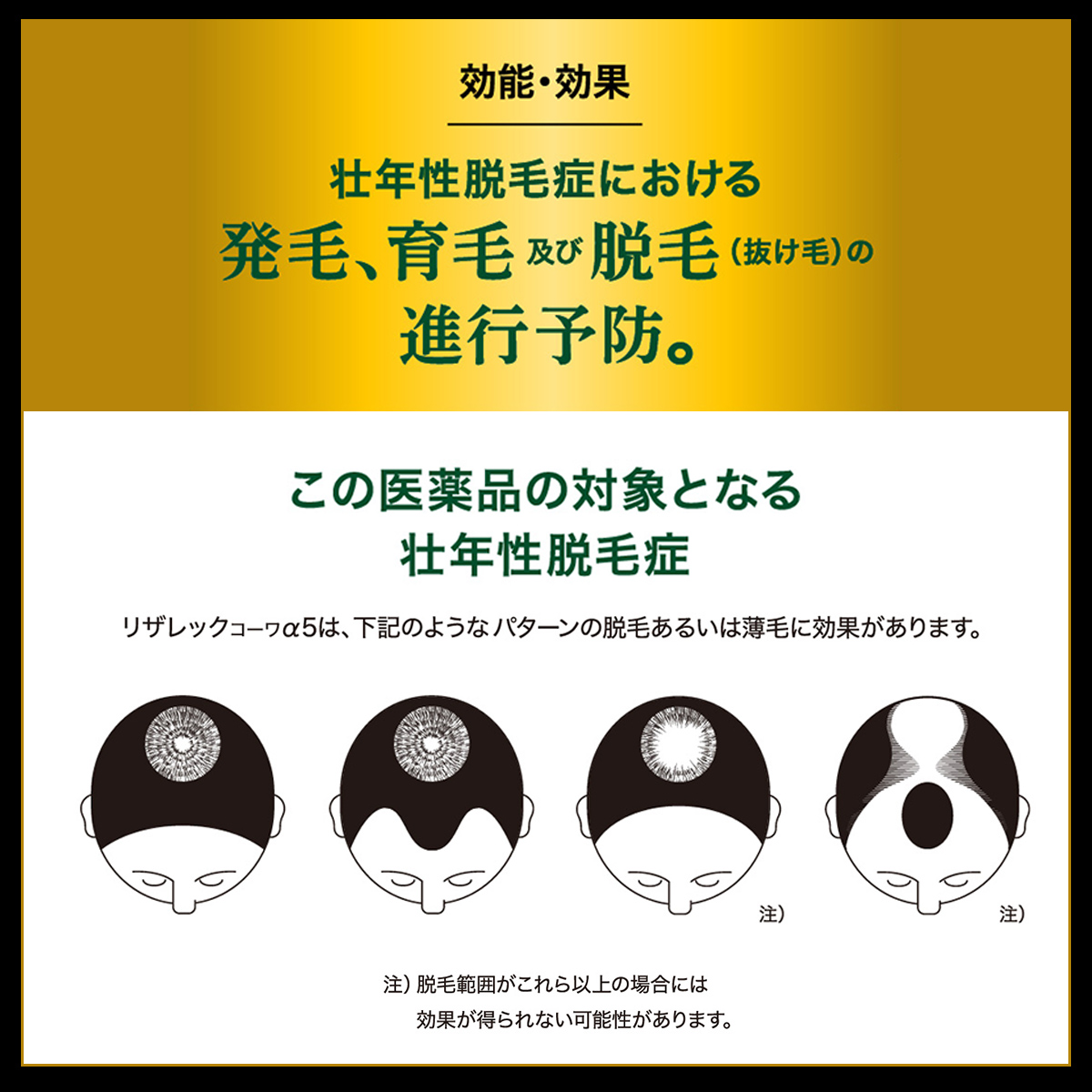 リザレックコーワα5　90mL 【第1類医薬品】 90mL