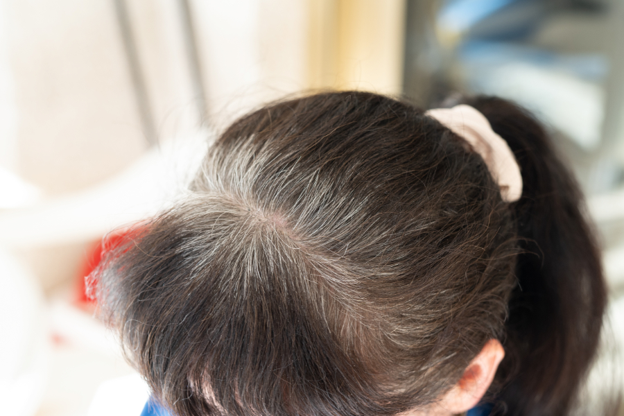 更年期の抜け毛対策は難しくない！ヘアケアや食事・睡眠習慣の見直し、発毛剤で健やかな髪を育てよう
